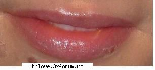 Bill Kaulitz Lip Injection - nush .. voi vedeti vreo diferenta cv?? =D - TOKIO HOTEL