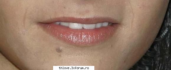 Bill Kaulitz Lip Injection - cele care urmeaza sunt poze din anii - TOKIO HOTEL