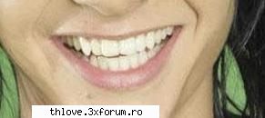 Bill Kaulitz Lip Injection - i_luv_bill - TOKIO HOTEL