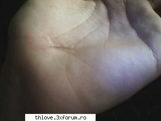 tomitza si cicatricea lui;) - ♫NǾi�y۞M�LǾdy♫ - T O M  K A U L I T Z